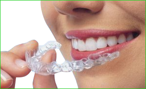 invisalign